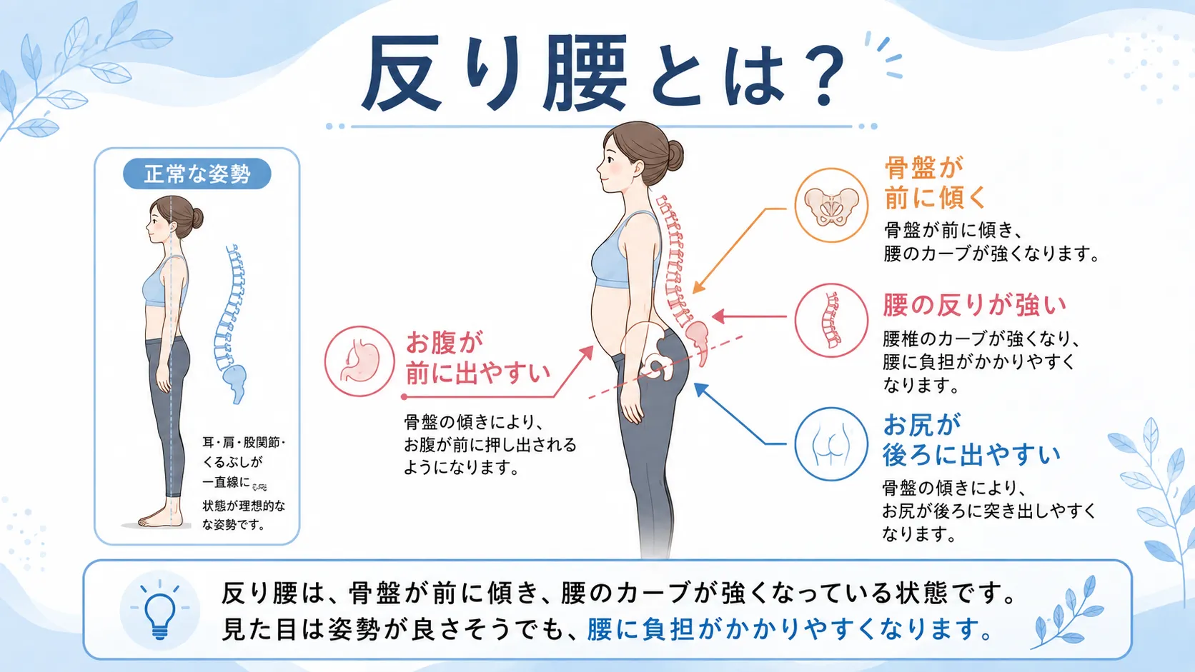 反り腰による腰痛は骨盤のゆがみが原因?骨盤矯正と鍼灸治療でできること